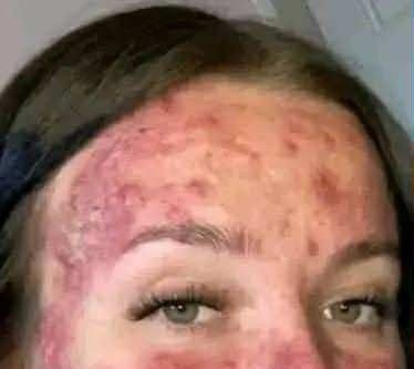 Her body was itching, I thought it was an allergy, they diagnosed ca… see more