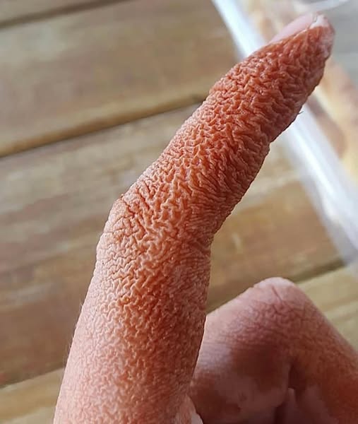 ALERT: These are the signs that it is cre…See more