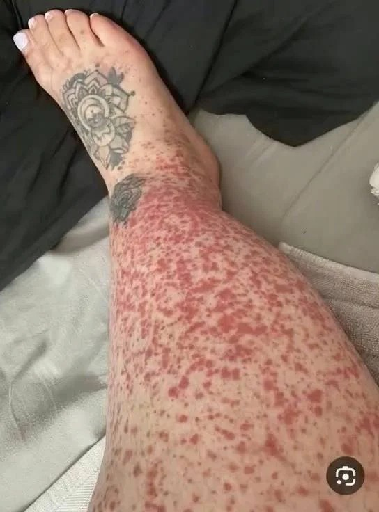 These are the consequences of sleeping with…See more