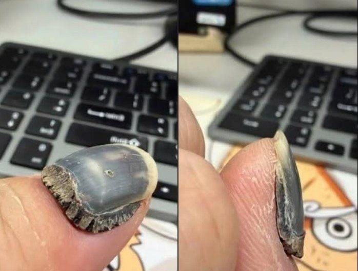 These are the consequences of using too much n… See more